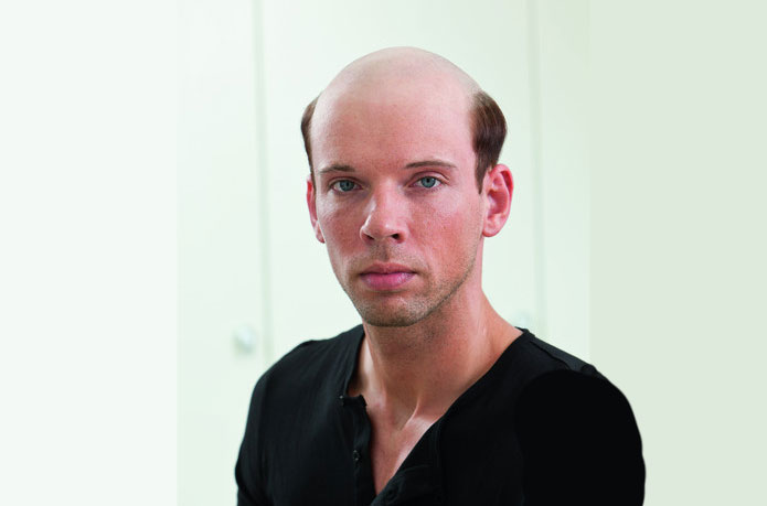Glatze adé im Haarcenter Hess in Rosenheim - Ihrem Zweithaarspezialist Glatze adé im Haarcenter Hess in Rosenheim - Ihrem Zweithaarspezialist
