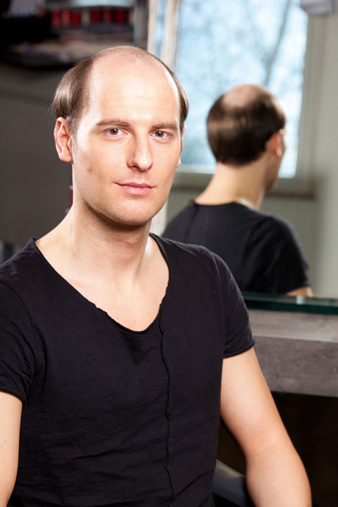 ContactSkin - Patrick vorher | Haarcenter Hess Zweithaarspezialist in Rosenheim ContactSkin - Patrick vorher | Haarcenter Hess Zweithaarspezialist in Rosenheim